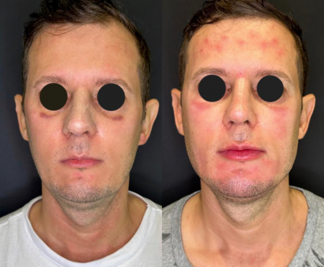 3A058242-1624-4362-85FD-2320A4247A83