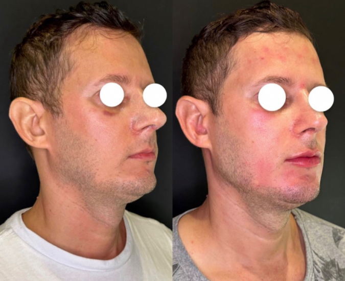 40803A67-EE1F-4CEB-A7C5-9C299881C6C0