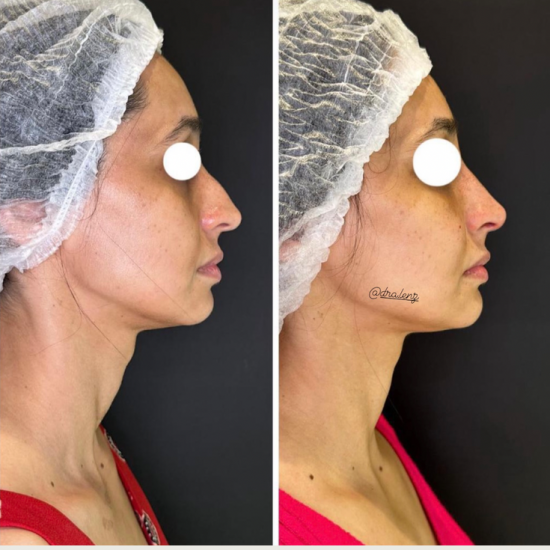 918D4B77-9CC6-481E-A77F-5A84C6CB2E51